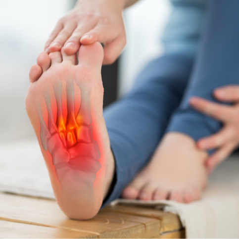 Plantar Fasciitis Treatment