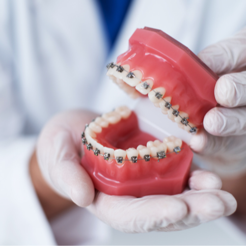 Orthodontic Treatment