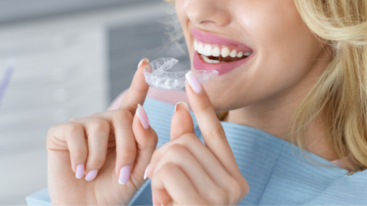  Clear Aligner