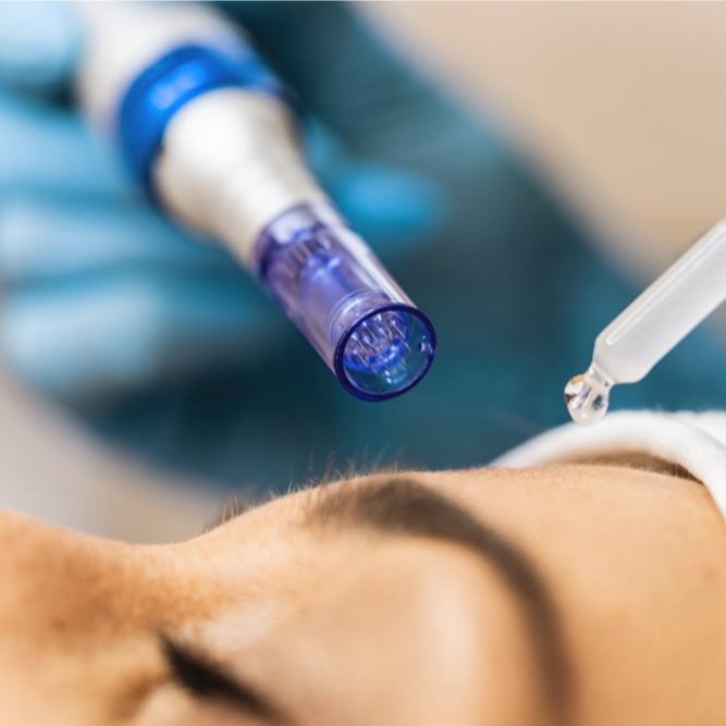 Save 50% on Microneedling | PricelessMed