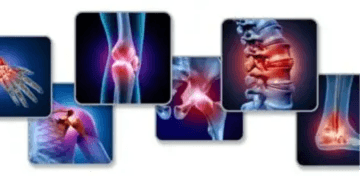 Physiotherapist Treatment Session - Mrs. Deepa