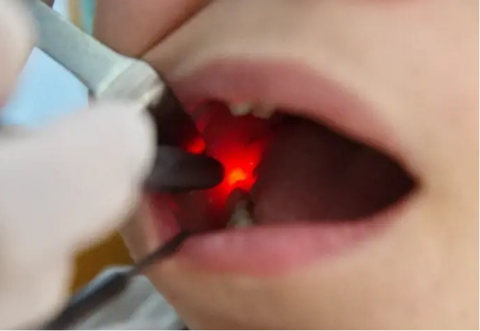 Kids Treatment Session - 20% OFF | PricelessMed