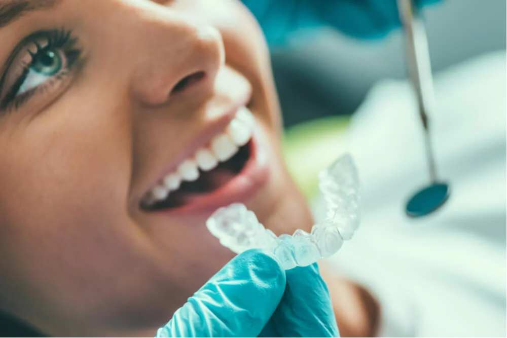Clear Braces  - 22% OFF | PricelessMed