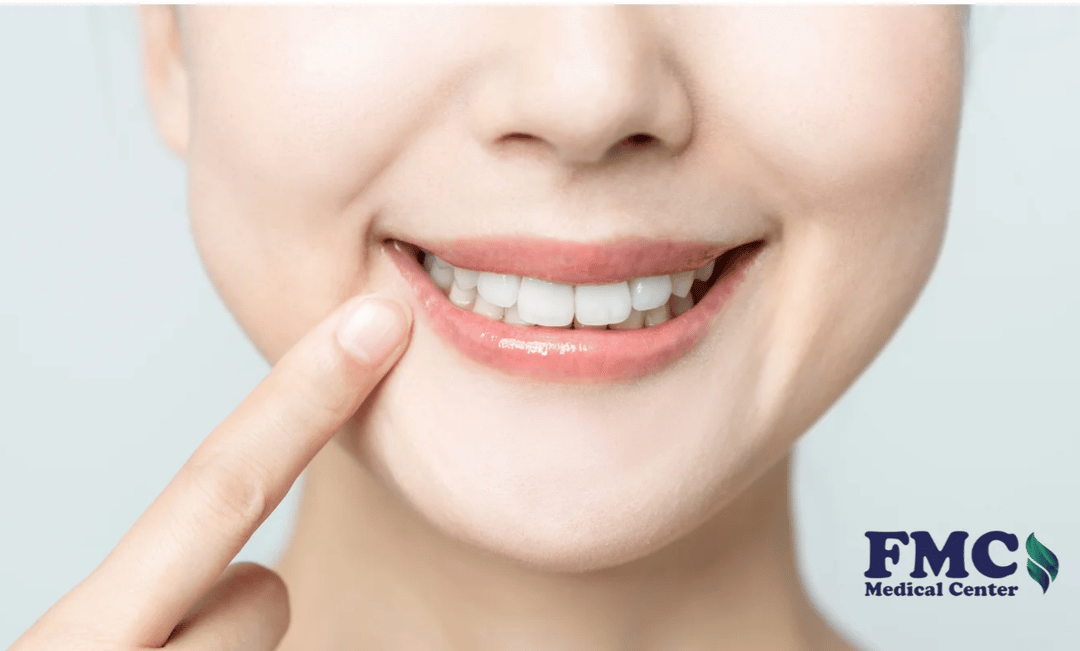 Consultation with Full-set Veneers - 25% OFF | PricelessMed