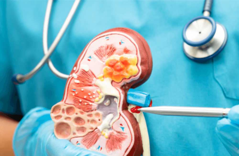 Renal Package  - 20% OFF | PricelessMed