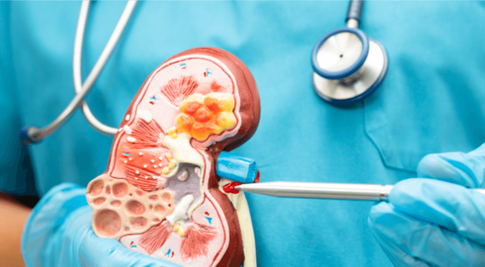 Renal Package  Discount | PricelessMed