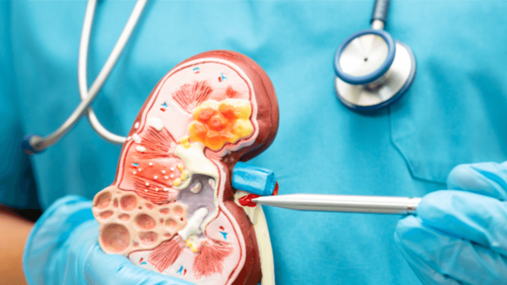 Renal Package  - 20% OFF | PricelessMed