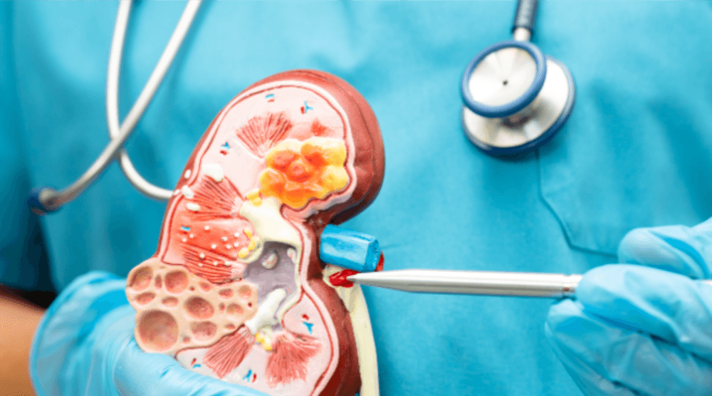 Renal Package  Discount | PricelessMed