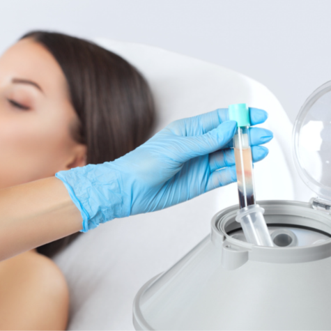 PRP with Microneedling  - 15% OFF | PricelessMed