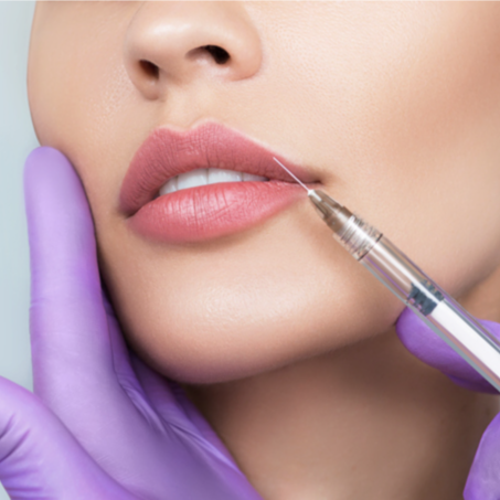 Consultation & Lip Filler - 15% OFF | PricelessMed