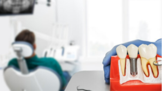 Hollywood Smile - 37% OFF | PricelessMed