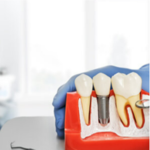Bollywood Smile - 55% OFF | PricelessMed