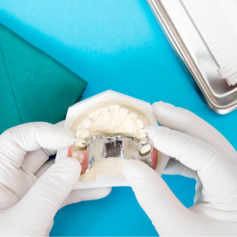 RPD (Removable Partial Dentures) - 15% OFF | PricelessMed