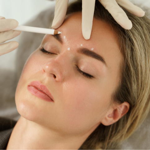 Consultation & Botox 12 Unit Discount | PricelessMed