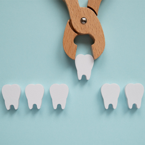 Molar Extraction - 15% OFF | PricelessMed