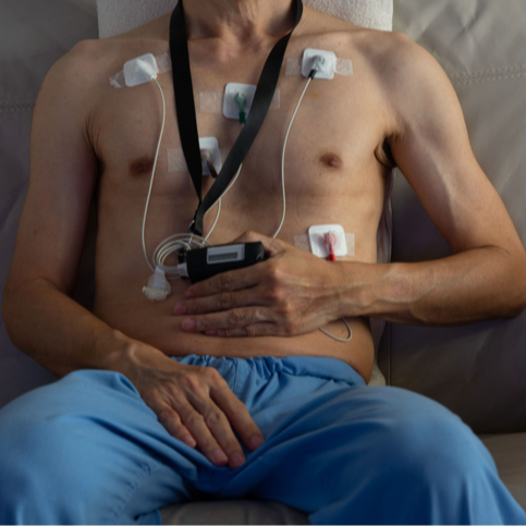 ECG Holter Discount | PricelessMed