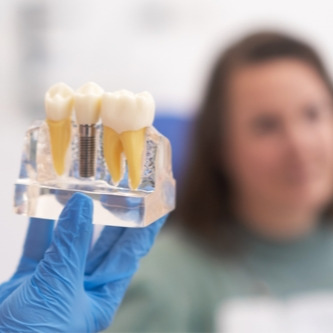 Consultation with Root Canal and Crown Discount | Pricele...