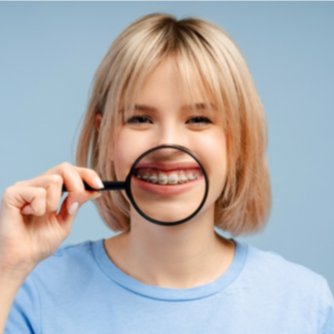 Save 15% on Orthodontic Consultation and Braces | Pricele...