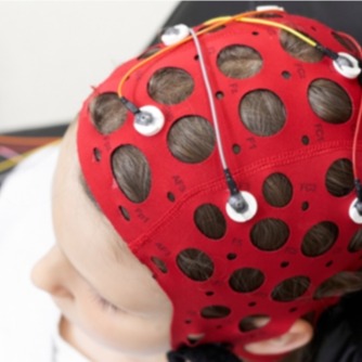 QEEG Brain Mapping Session (60 Minutes) Discount | Pricel...