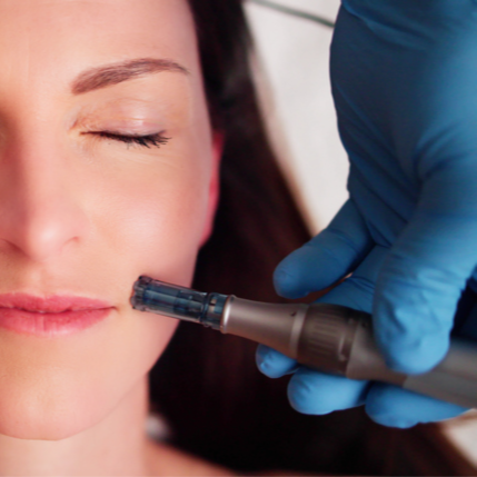 Dermapen [Microneedling] - 20% OFF | PricelessMed