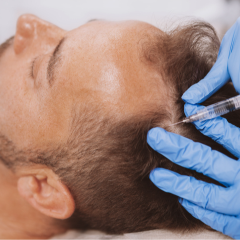 Save 20% on Hair Filler  | PricelessMed