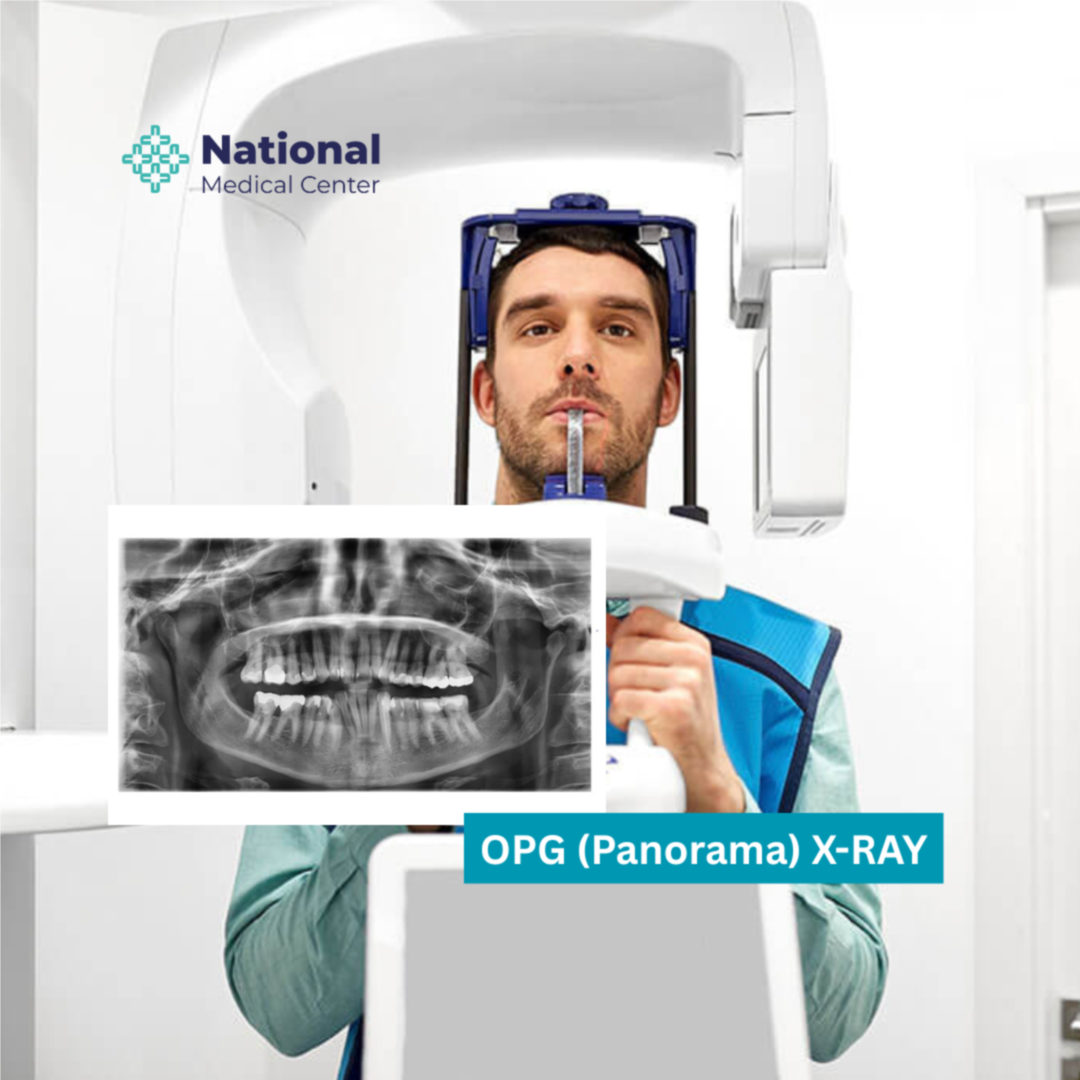 Panoramic X-ray for the teeth (OPG X-ray) Discount | Pric...